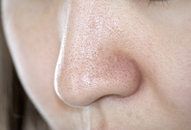 ワセリンは毛穴詰まりに効果的？いちご鼻や角栓への効果と悪化させない正しい方法